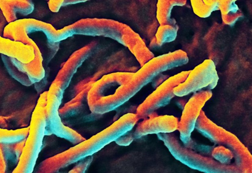 Army Scientists Striving to Develop Ebola Vaccine